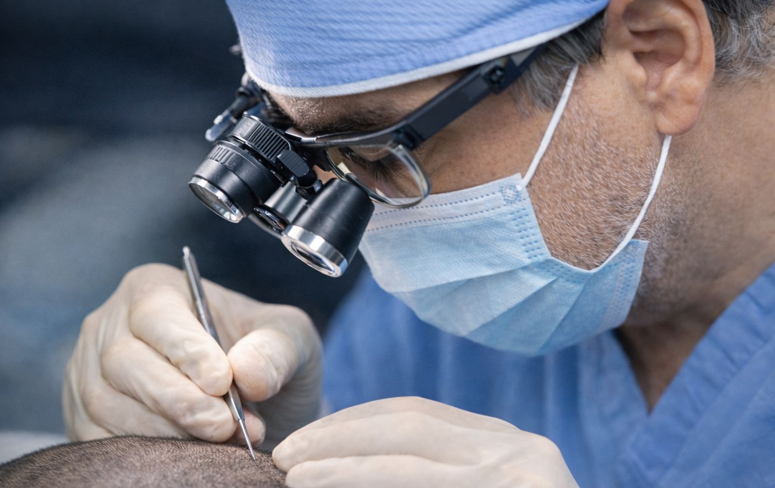 Capilea México Releases Overview of Hair Transplant Success Rates and FUE Technology in Mexico