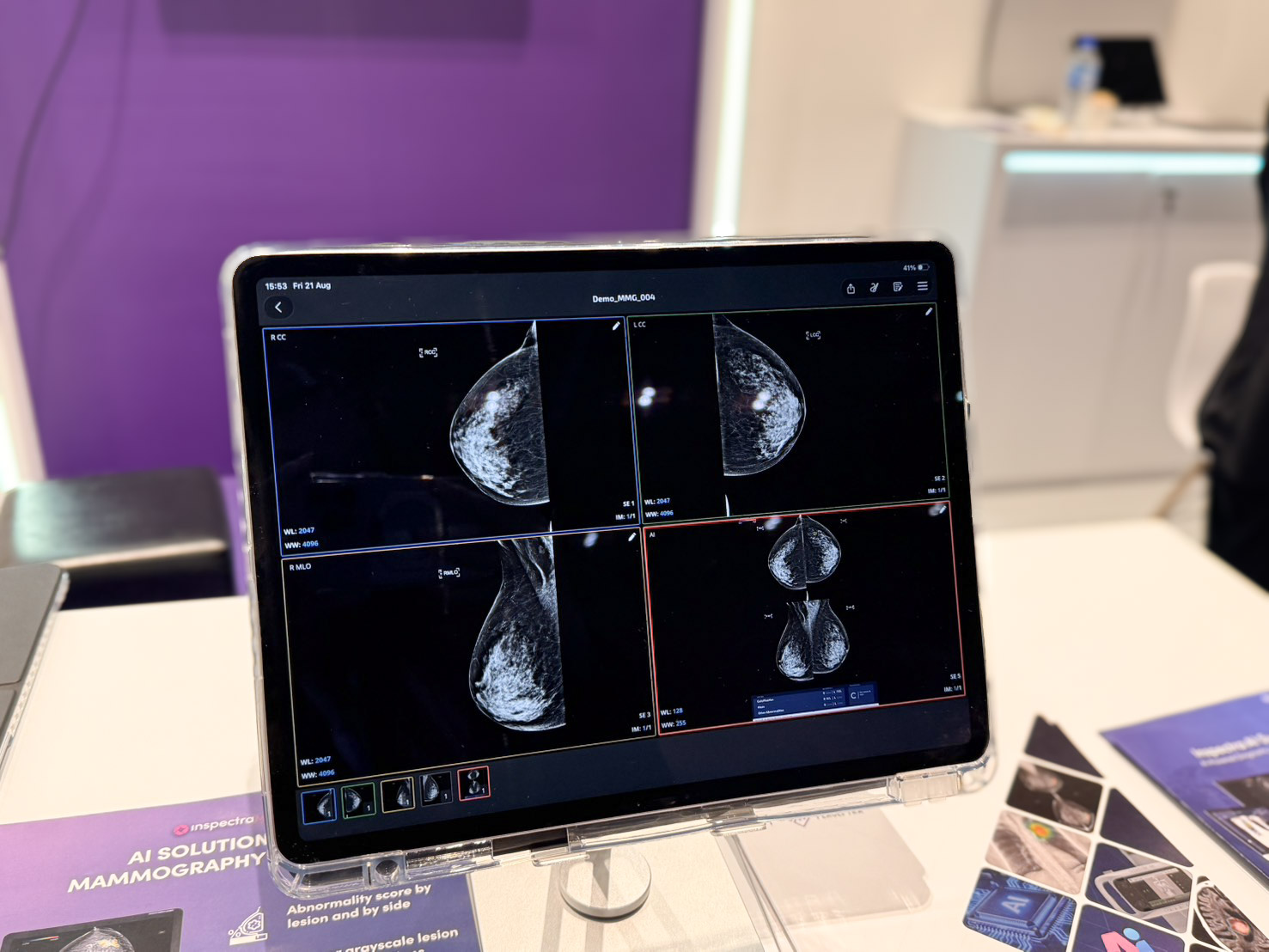 Perceptra, a Thai Startup, Brings Medical AI to International Markets to Enhance Regional Patient Screening